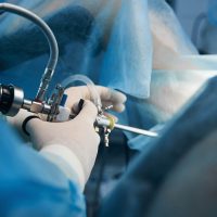 histeroskopia-macicy